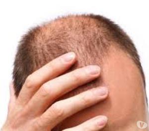 STOP HAIR LOSS & GROW NATURALLY NEW HAIRS FROM ROOT Kolhapur