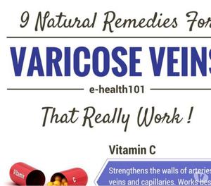 Varco Phyto varicose veins treatment in kolkata, bangalore &