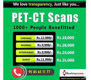 PET CT scan cost in Chennai - 100% lowest cost guaranteed