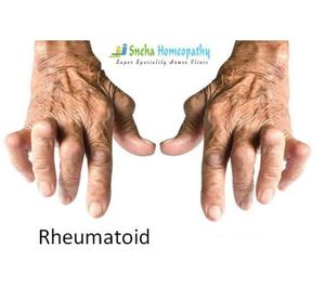 Homeopathic Doctors For Rheumatoid Hyderabad
