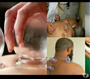 Salaam Hijama In Hyderabad Cupping Therapy Hyderabad
