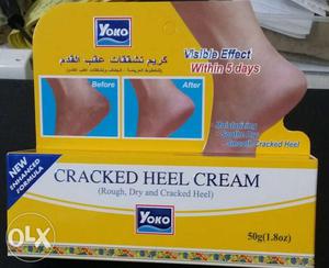 Yoko Cracked Heel Cream Box