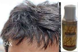 सफ़ेद बालों को जड़