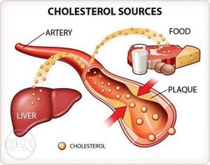 Reduce your cholestrol in one month