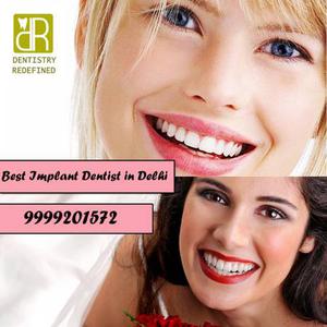 Book an Appointment with Best Implant Dentist in Delhi
