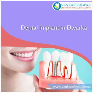 Book Appointment Online for Dental Implant in Dwarka