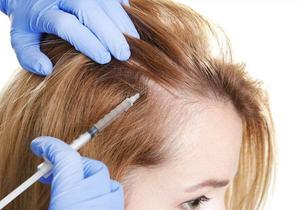 Hair Loss Treatment in Indore