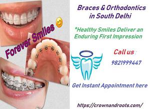 Braces and Orthodontics in South Delhi | Crownandroots