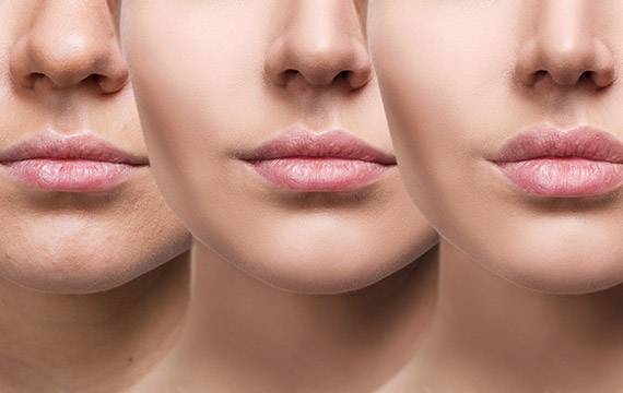 lip enhancement surgery in Delhi