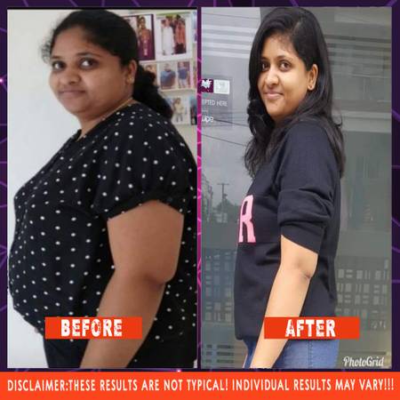 Weight loss/Gain Center in Secunderabad