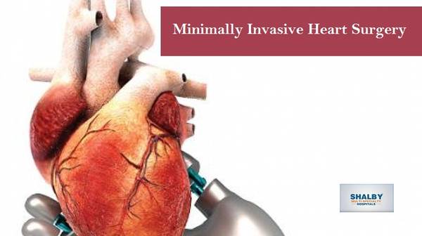 Minimally Invasive Heart Surgery in Ahmedabad