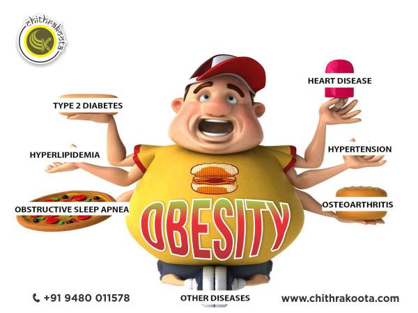 Curing Obesity with Chithrakoota Ayurveda (Udupi)