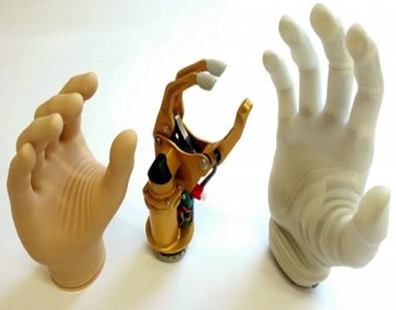 Quality Orthotics Prosthetics which Ensure a Great Support