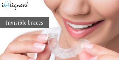 INVISIBLE ALIGNERS FOR TEETH