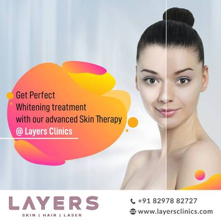 Best Skin Lifting Treatment in Hyderabad | Layers Clinics