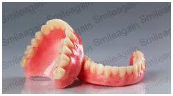 Orthodontics Dental Implant Mumbai