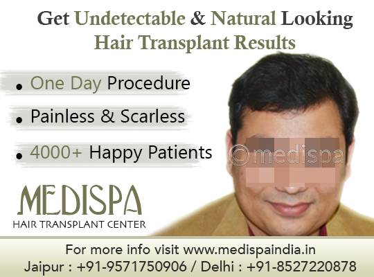Hair Transplant Clinics in Jaipur