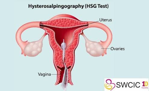 infertility center in hyderabad
