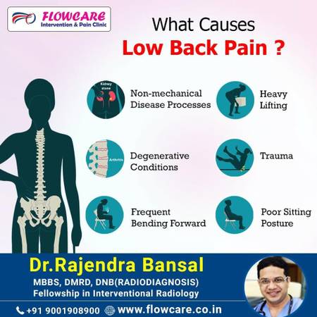 What Causes LowBack Pain?
