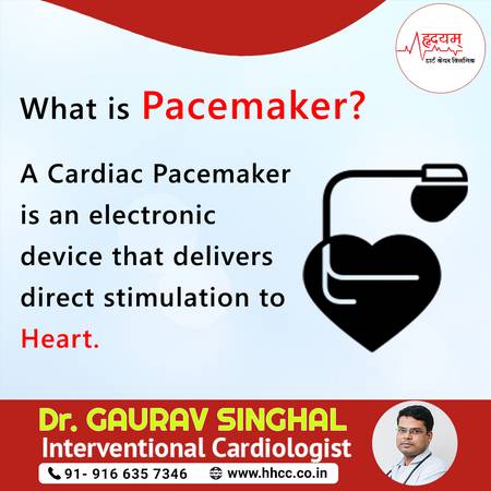 What is Pacemaker