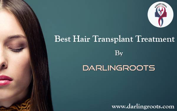 Best FUE Hair Transplant Clinic in Hyderabad | Darling Roots