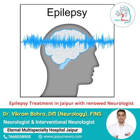Book an appointment for Epilepsy Treatment in Jaipur