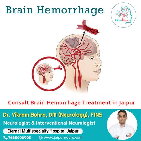 Dr. Vikram Bohara offering Brain hemorrhage treatment in