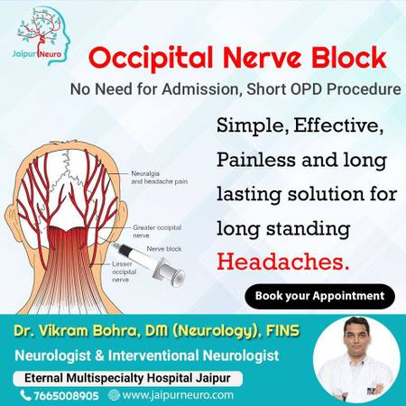 Get Occipital Nerve Block treatment