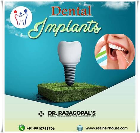 Dental Implant Treatment in Gurgaon