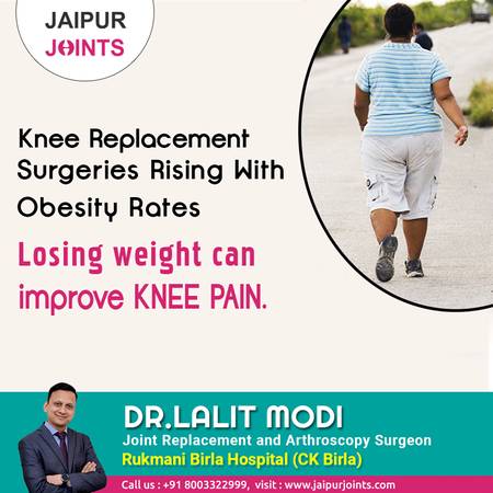 Get Knee Replacement Surgeries