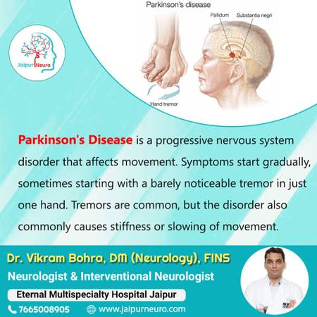 Get Parkinson's treatment in Jaipur