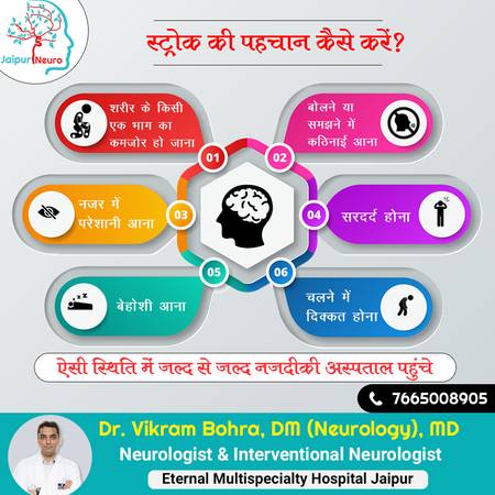 How to identify stroke (paralysis)?