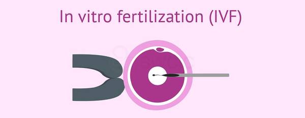 IVF Treatment in Hyderabad.swcic