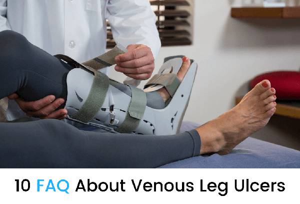 10 FAQ About Venous Leg Ulcers