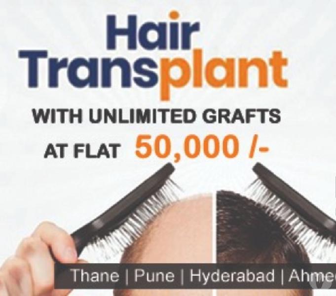 Hair Transplant for Men in Thane