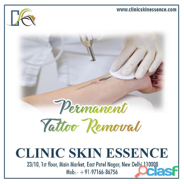 Consult for Permanent Laser Hair Removal in Delhi