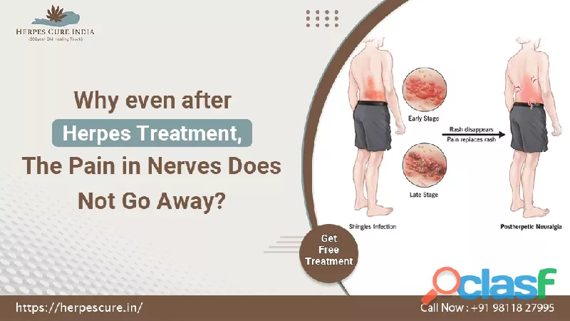 Looking For The Treatment For Herpes Pain In Nerves Does Not