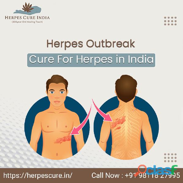 Where to get Herpes Treatment in India for a Cure