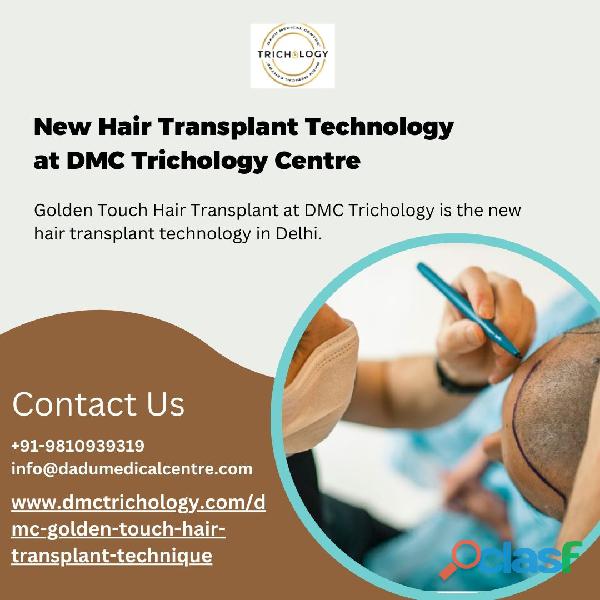 New Hair Transplant Technology at DMC Trichology Centre