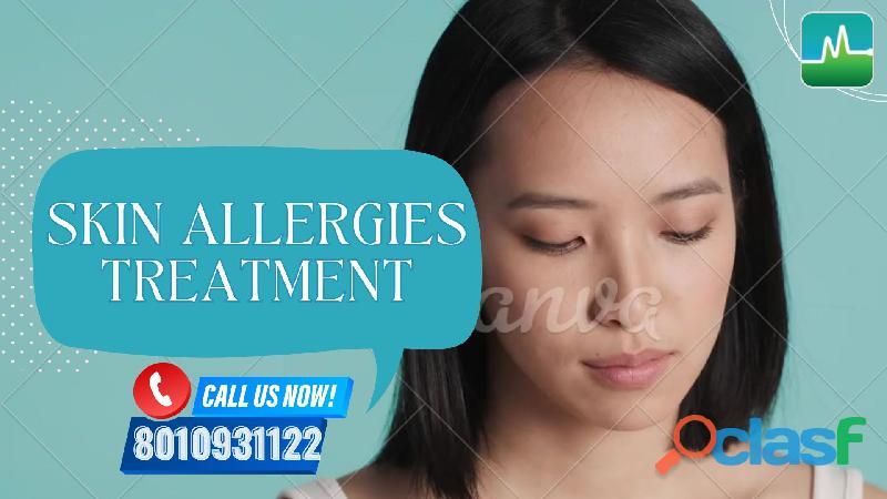 Skin allergies treatment in Dwarka Delhi Call 8010931122