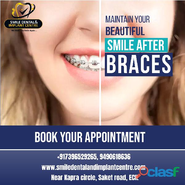 Maintain your Beautiful Smile after Braces | Smile Dental &