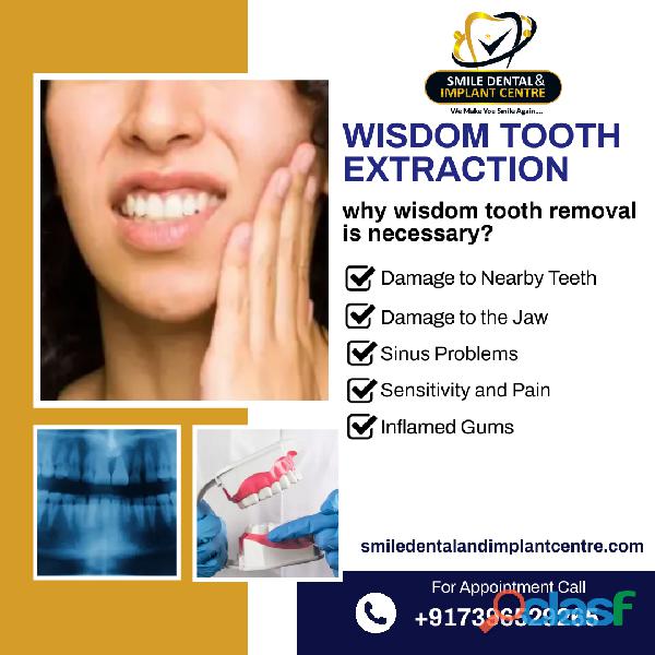 Best Dentist near me for Wisdom Teeth Removal